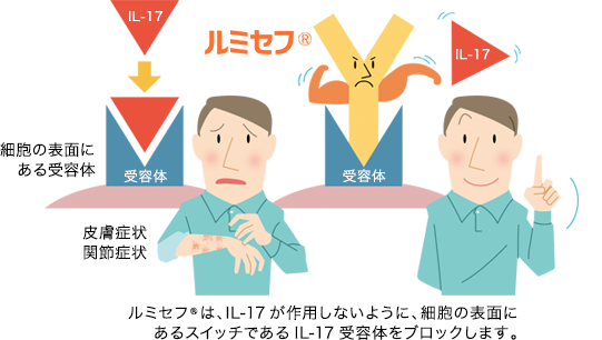 ルミセフは、IL-17が作用しないように、細胞の表面にあるスイッチであるIL-17受容体をブロックします。