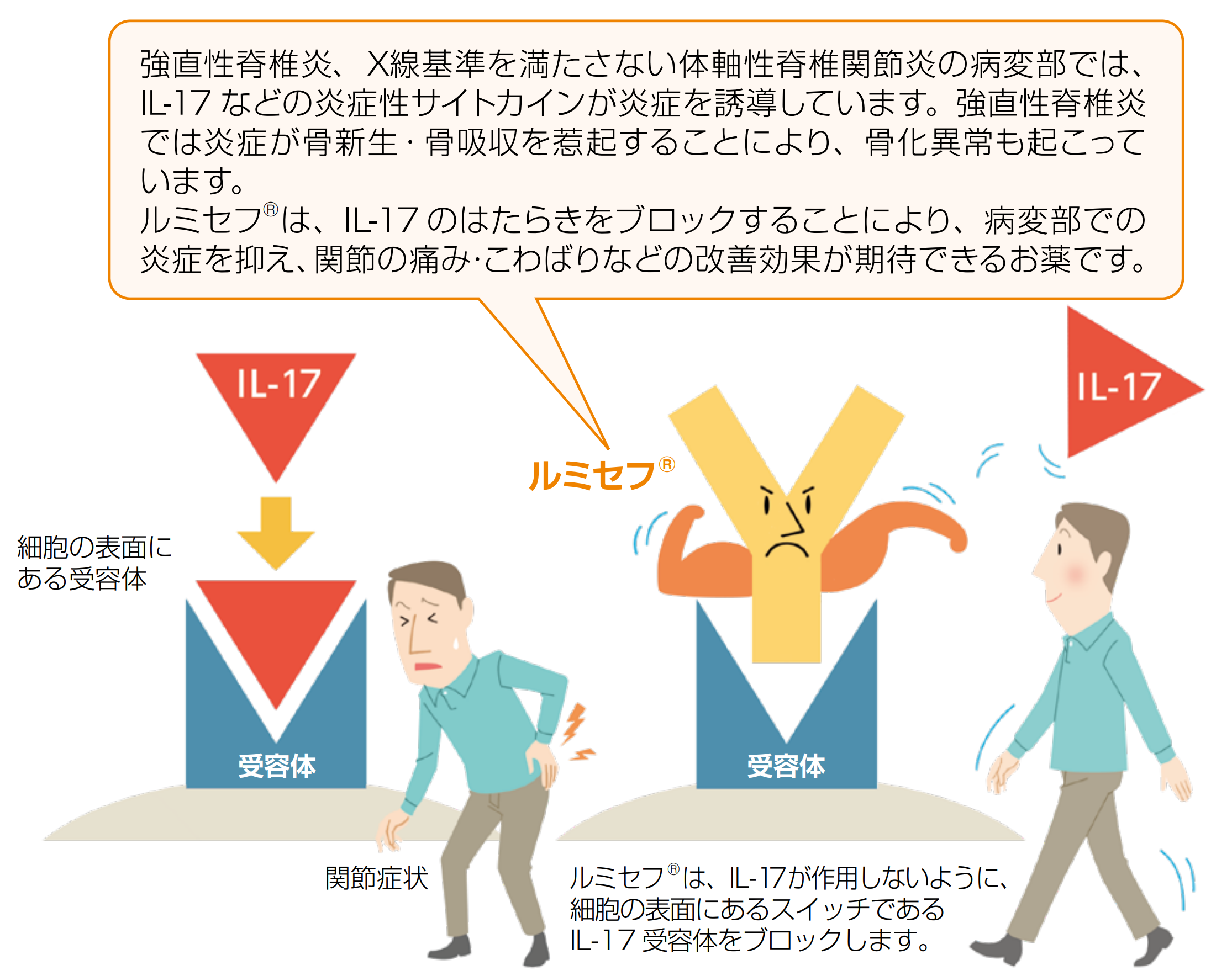 ルミセフは、IL-17が作用しないように、細胞の表面にあるスイッチであるIL-17受容体をブロックします。