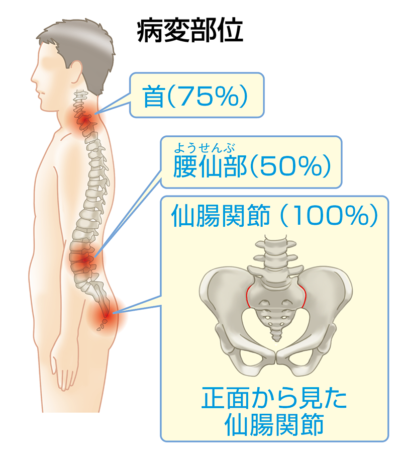 病変部位